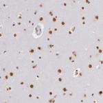 hnRNP H2 Antibody in Immunohistochemistry (IHC)