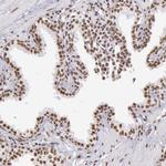 hnRNP H2 Antibody in Immunohistochemistry (IHC)