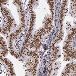 hnRNP H2 Antibody in Immunohistochemistry (IHC)