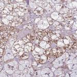 CXorf57 Antibody in Immunohistochemistry (Paraffin) (IHC (P))