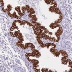 CXorf57 Antibody in Immunohistochemistry (Paraffin) (IHC (P))