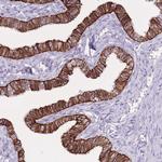 CXorf57 Antibody in Immunohistochemistry (Paraffin) (IHC (P))