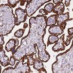 CXorf57 Antibody in Immunohistochemistry (Paraffin) (IHC (P))