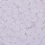 CXorf57 Antibody in Immunohistochemistry (Paraffin) (IHC (P))