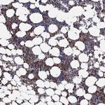 FES Antibody in Immunohistochemistry (Paraffin) (IHC (P))