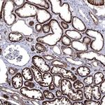 FES Antibody in Immunohistochemistry (Paraffin) (IHC (P))