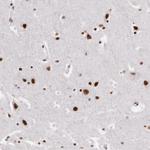 PNN Antibody in Immunohistochemistry (Paraffin) (IHC (P))
