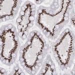 PNN Antibody in Immunohistochemistry (Paraffin) (IHC (P))