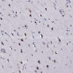 SIX6 Antibody in Immunohistochemistry (Paraffin) (IHC (P))