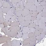 SIX6 Antibody in Immunohistochemistry (Paraffin) (IHC (P))