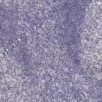 SIX6 Antibody in Immunohistochemistry (Paraffin) (IHC (P))
