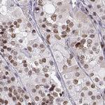SIX6 Antibody in Immunohistochemistry (IHC)