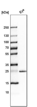 SIX6 Antibody in Western Blot (WB)