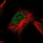 ATG2B Polyclonal Antibody