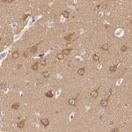 ATG2B Antibody in Immunohistochemistry (Paraffin) (IHC (P))