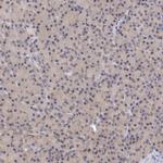 ATG2B Antibody in Immunohistochemistry (Paraffin) (IHC (P))