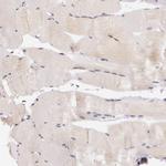 ATG2B Antibody in Immunohistochemistry (Paraffin) (IHC (P))