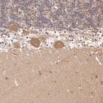ATG2B Antibody in Immunohistochemistry (IHC)