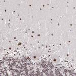 C6orf15 Polyclonal Antibody