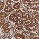 ASCC2 Antibody in Immunohistochemistry (Paraffin) (IHC (P))