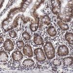 VRTN Polyclonal Antibody