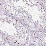 CTCFL Antibody in Immunohistochemistry (IHC)