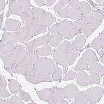 CTCFL Antibody in Immunohistochemistry (IHC)
