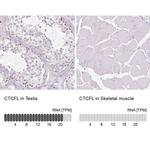 CTCFL Antibody