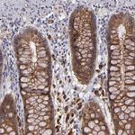 SYTL4 Antibody in Immunohistochemistry (Paraffin) (IHC (P))