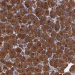 SYTL4 Antibody in Immunohistochemistry (Paraffin) (IHC (P))