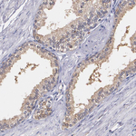 PTS Antibody in Immunohistochemistry (Paraffin) (IHC (P))