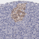 PTS Antibody in Immunohistochemistry (Paraffin) (IHC (P))