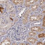 PTS Antibody in Immunohistochemistry (IHC)