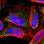 ZNF133 Polyclonal Antibody