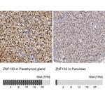 ZNF133 Antibody in Immunohistochemistry (IHC)
