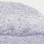 SMC1B Antibody in Immunohistochemistry (IHC)