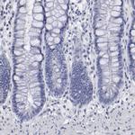 SMC1B Antibody in Immunohistochemistry (IHC)
