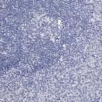 SMC1B Antibody in Immunohistochemistry (IHC)