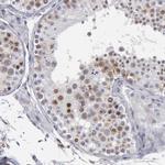SMC1B Antibody in Immunohistochemistry (IHC)