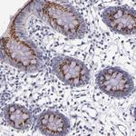 RAB41 Polyclonal Antibody