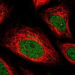 IFNGR2 Polyclonal Antibody