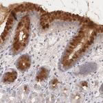 IFNGR2 Antibody in Immunohistochemistry (Paraffin) (IHC (P))