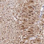 STX8 Polyclonal Antibody