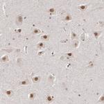 INTS6 Polyclonal Antibody