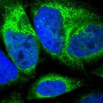 CYB5R3 Polyclonal Antibody