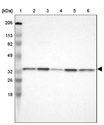 CYB5R3 Antibody in Western Blot (WB)