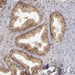 EFS Antibody in Immunohistochemistry (Paraffin) (IHC (P))