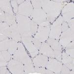 EFS Antibody in Immunohistochemistry (Paraffin) (IHC (P))