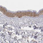 EFS Antibody in Immunohistochemistry (Paraffin) (IHC (P))