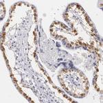 MBNL3 Antibody in Immunohistochemistry (Paraffin) (IHC (P))